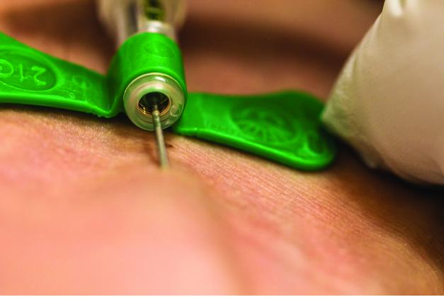 Health care workers can take the time to refresh safety practices regarding sharps to protect the entire team. (Courtesy photo)