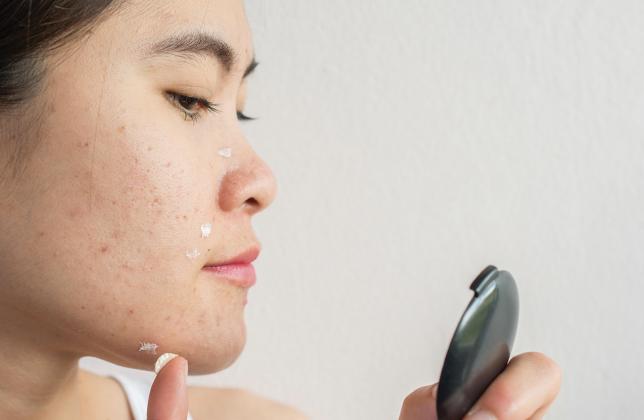 Here are some common skin conditions and how to address them.