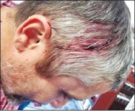 when he assaulted Cory Jones (right). Gilbert must serve two of the ten years.