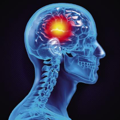 What people can do to prevent stroke
