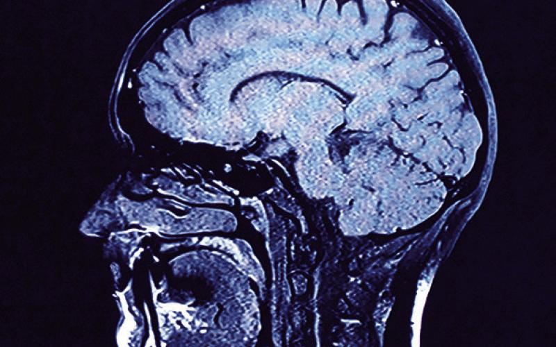 Mild traumatic brain injuries are more common than people may realize.