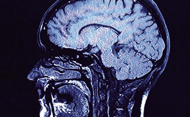 Mild traumatic brain injuries are more common than people may realize.